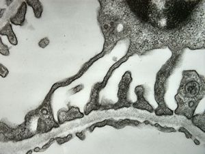 normal kidney - mouse(endothelium and podocyte) normal kidney - mouse(endothelium and podocyte)